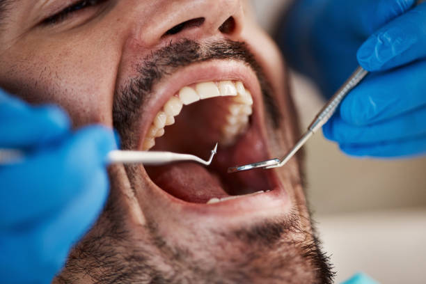 Best Cracked Tooth Emergency Dentist  in Vancleave, MS